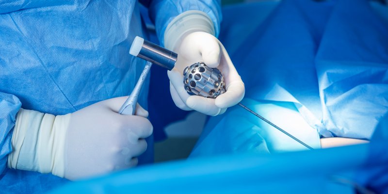 Surgeon performs endoscopic microdiscectomy of herniated intervertebral disc.