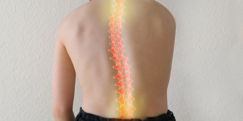 Essential insights into the Scoliosis Diseases.