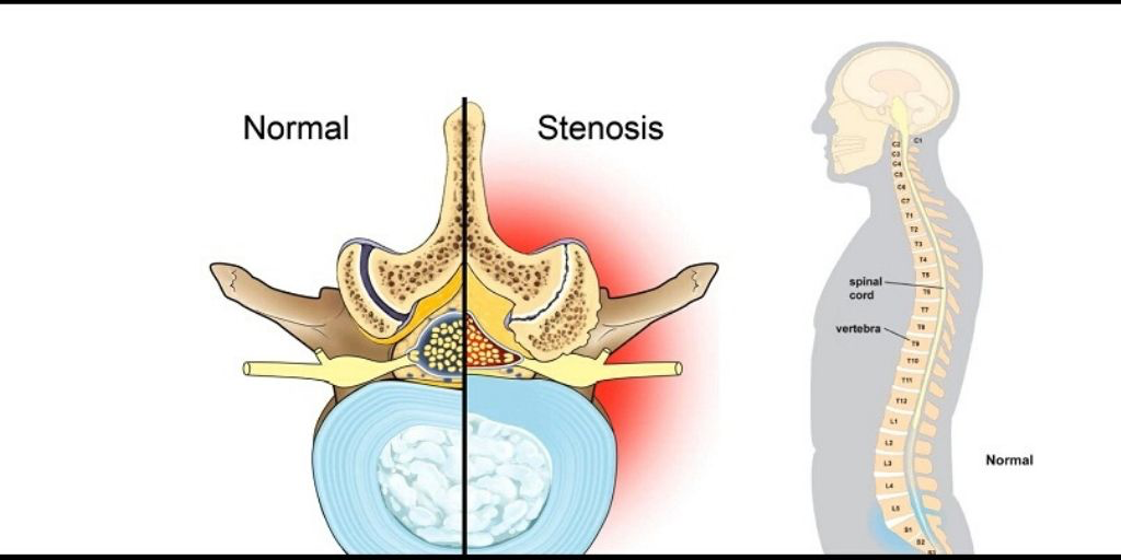 The images of the spine during the minimally invasive treatment procedures.