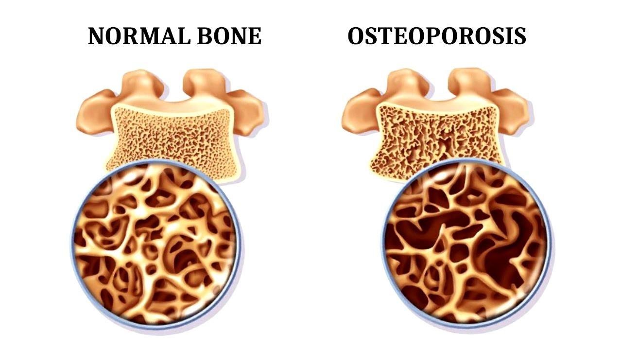 The images of the spine during the minimally invasive treatment procedures.